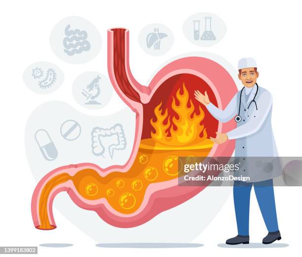 ilustraciones, imágenes clip art, dibujos animados e iconos de stock de médico hablando sobre la acidez estomacal. gastroenterología. examen médico. - acid