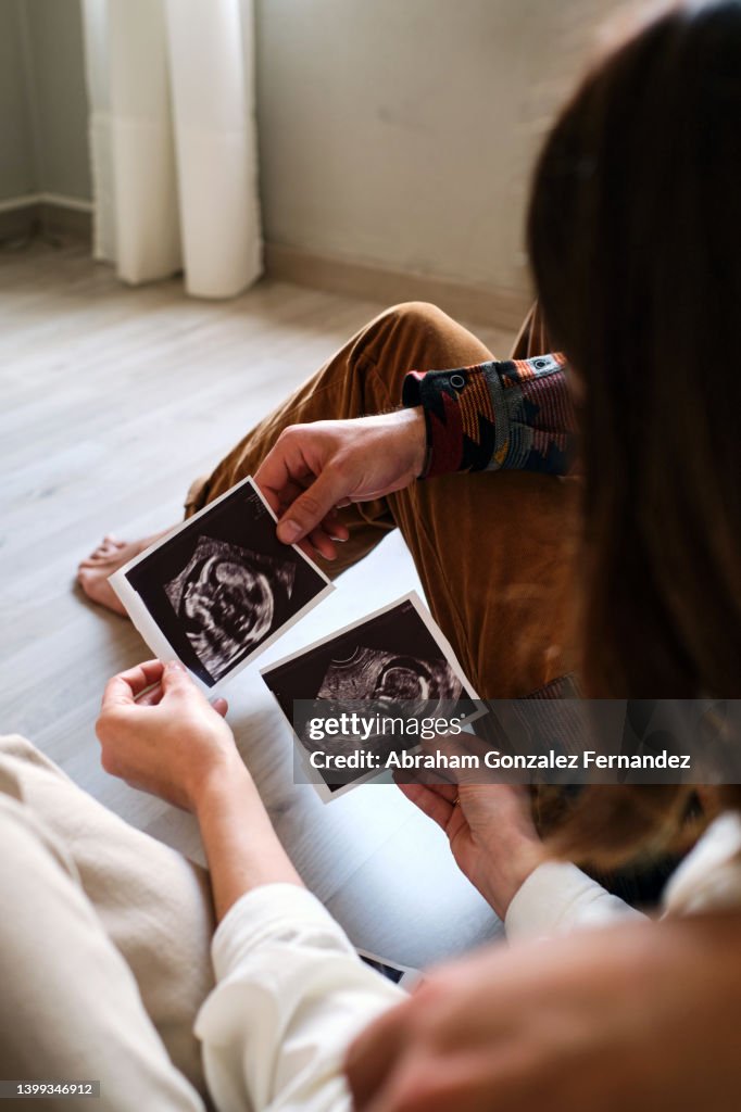 Couple Looking At Ultrasound Of Their Baby High-Res Stock Photo