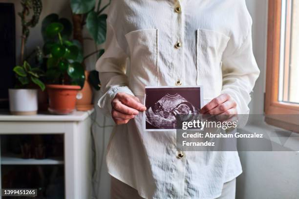 woman standing showing ultrasound of the baby she is expecting. - baarmoeder stockfoto's en -beelden