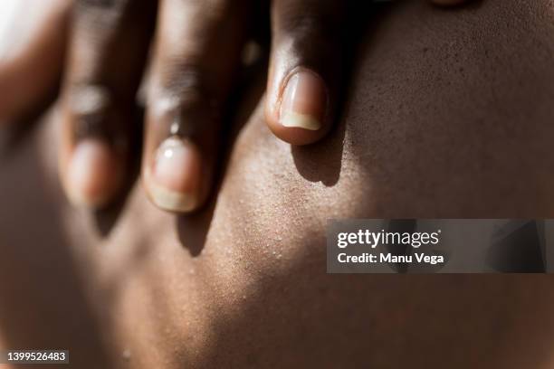 close-up view of woman applying acne cream to her body at home. - dermatologia fotografías e imágenes de stock