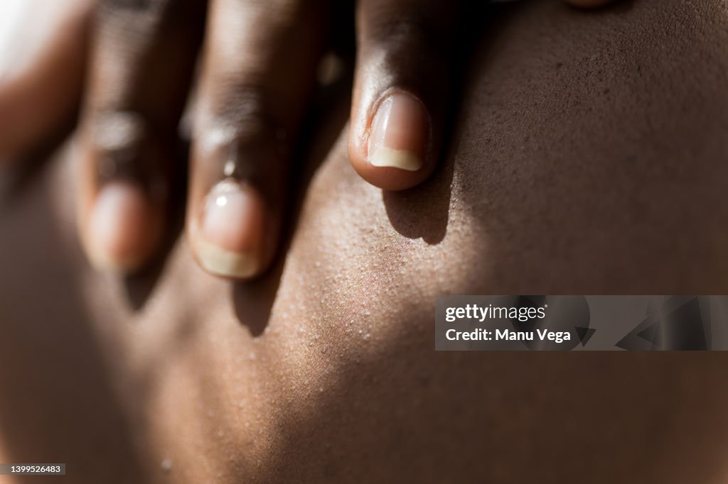 Close-up view of woman applying acne cream to her body at home.