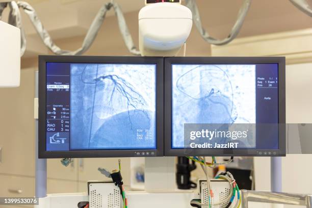 view of modern medical x-ray operating room (cath lab) - pathology lab stock pictures, royalty-free photos & images