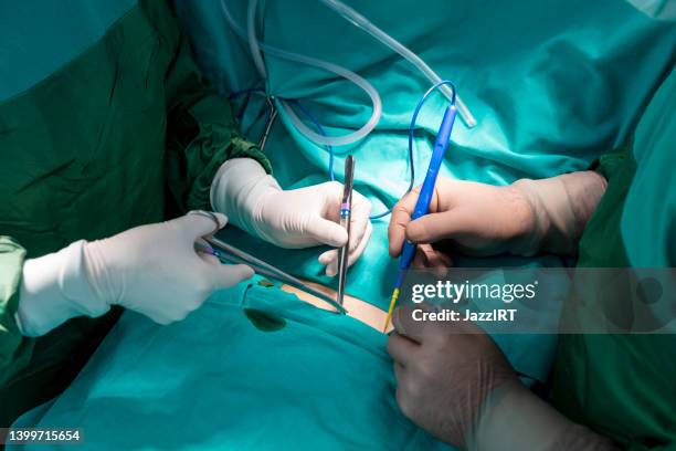 surgeon and patient - plastic surgeon stock pictures, royalty-free photos & images