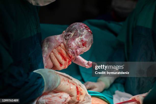 birth surgery with cesarean section - family photo in the delivery room stock pictures, royalty-free photos & images