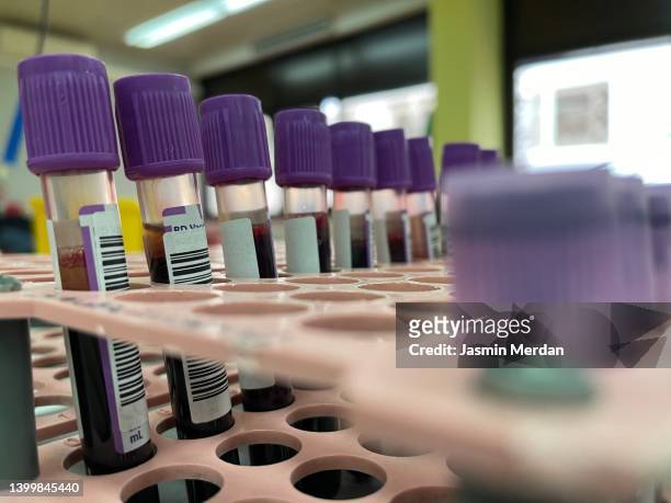 monkeypox blood samples - bluttest stock-fotos und bilder