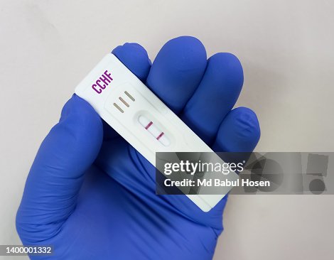 Rapid test device or cassette for Crimean-Congo hemorrhagic fever(CCHF) virus test, Nairovirus test, Tick borne virus, Nosebleed fever. Rapid test device or cassette for Crimean-Congo hemorrhagic fever(CCHF) virus test, Nairovirus test, Tick borne virus, Nosebleed fever.