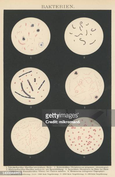 old chromolithograph illustration of magnification of bacteria - anthrax 個照片及圖片檔
