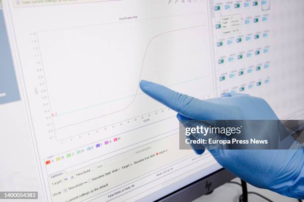 Computer screen with positive results for monkeypox, at the Hospital Ramon y Cajal, on 30 May, 2022 in Madrid, Spain. The Community of Madrid begins...