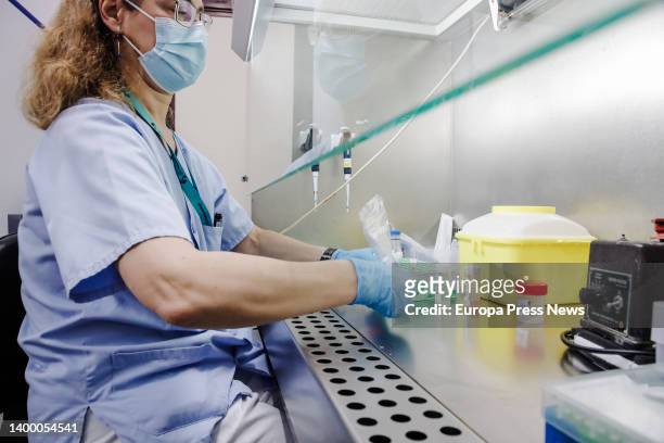 Nurse holds one of the tests for monkeypox at the Hospital Ramon y Cajal, May 30 in Madrid, Spain. The Community of Madrid begins today to carry out...