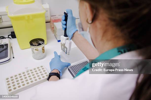 Nurse prepares a PCR for monkeypox testing, at the Hospital Ramon y Cajal, on 30 May, 2022 in Madrid, Spain. The Community of Madrid begins today to...