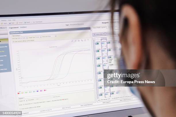 Computer screen with positive results for monkeypox, at the Hospital Ramon y Cajal, on 30 May, 2022 in Madrid, Spain. The Community of Madrid begins...
