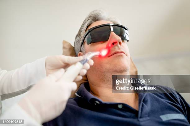 mature man receiving laser treatment in cosmetology clinic - laser face stock pictures, royalty-free photos & images