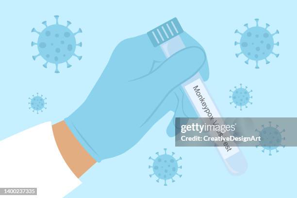 illustrazioni stock, clip art, cartoni animati e icone di tendenza di mano dello scienziato che indossa un guanto protettivo e tiene in mano la provetta del test del virus del vaiolo delle scimmie - test tube