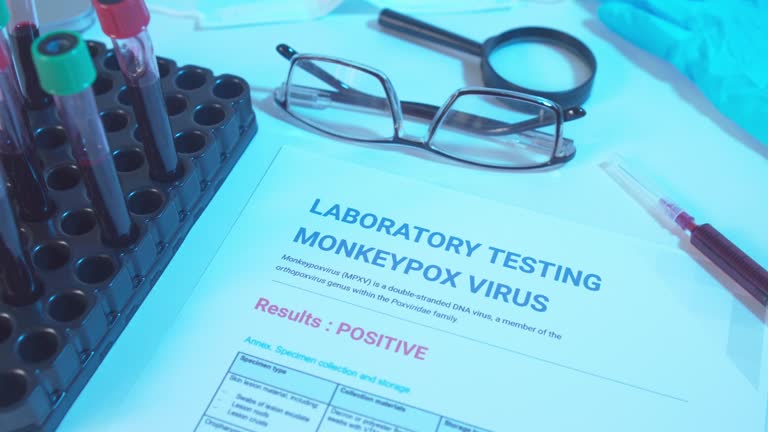 Monkeypox Testing Video 50 Blood Test Tube Collection Stock Videos, Footage, & 4K Video Clips ...