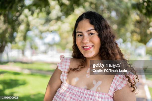 porträt einer jungen frau im freien - vitiligo stock-fotos und bilder