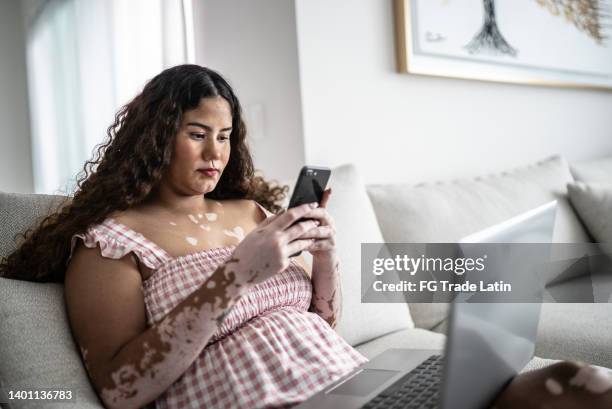 young woman using laptop and mobile phone at home - addiction mobile and laptop stockfoto's en -beelden