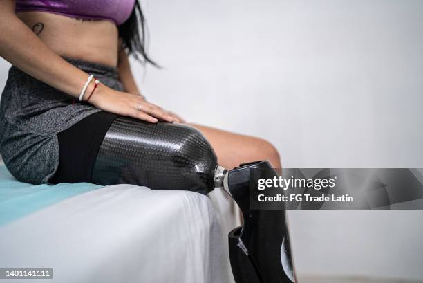 disabled mid adult woman sitting at the doctor's office - carbon fibre stock pictures, royalty-free photos & images