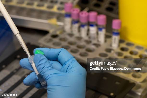 Medical laboratory technician inactivates suspected monkeypox samples to be PCR tested at the microbiology laboratory of La Paz Hospital on June 06,...