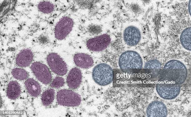 Digitally-colorized electron microscopic image depicting a monkeypox virion , obtained from a clinical sample associated with a 2003 prairie dog...