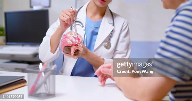 doctor explain brain model - concussion imagens e fotografias de stock