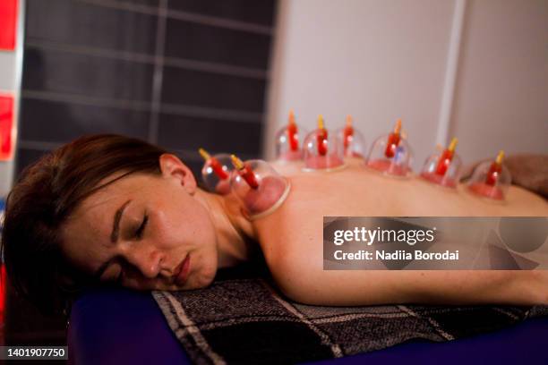 multiple vacuum cup of medical cupping therapy on human body - blood flow stock pictures, royalty-free photos & images