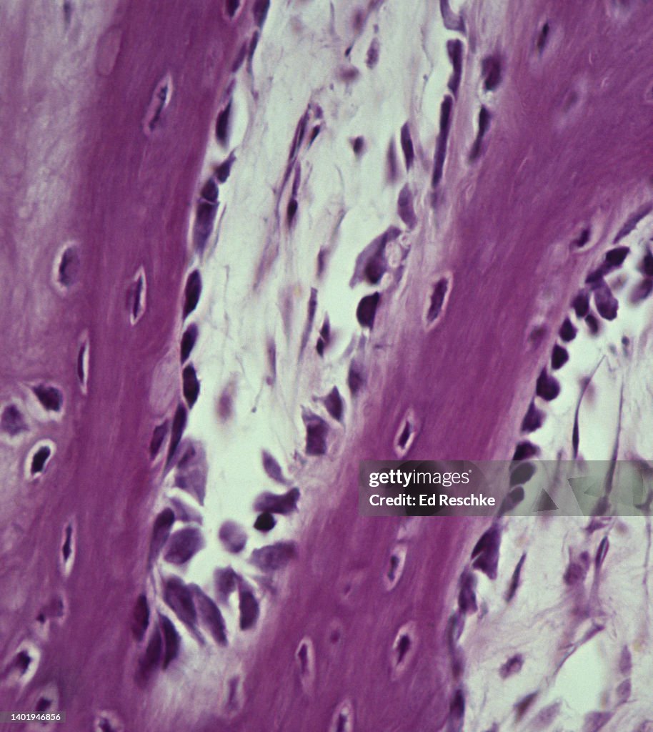 OSEOBLASTS and OSTEOCYTES in Developing Bone (ENDOCHONDRAL BONE,