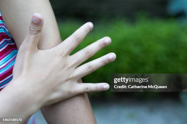 young mixed-race female hits mosquito on her arm - lyme disease stock pictures, royalty-free photos & images