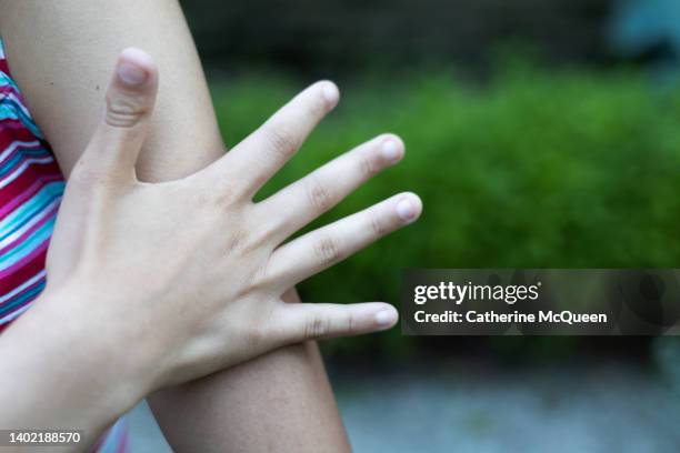 young mixed-race female hits mosquito on her arm - mosquito bite stock pictures, royalty-free photos & images