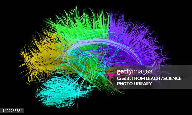 Visualized Brain Normal 75 Normal Brain Mri Stock Photos, High-Res Pictures, and Images - Getty ...