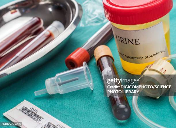 urine and blood samples at hospital table, conceptual image - a container for urine stock pictures, royalty-free photos & images