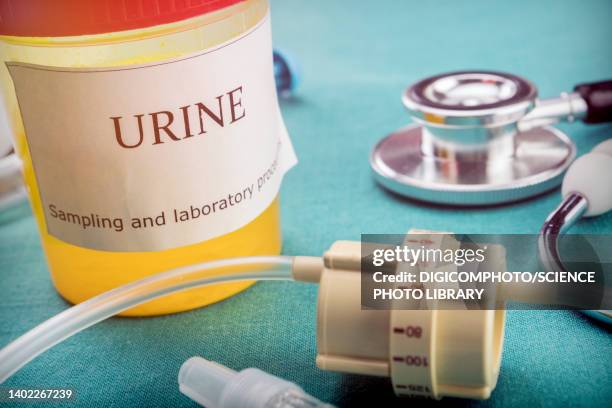 dial flow next to a urine sample at a hospital table - urologie stock-fotos und bilder