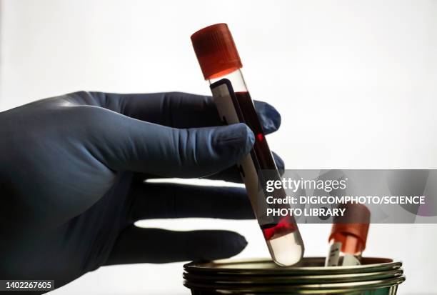 doctor holding a blood sample - syringe full of blood stockfoto's en -beelden