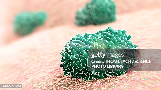 Monkeypox virus emerging from cell, illustration Monkeypox virus emerging from cell, illustration