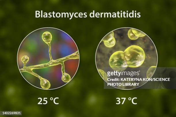 ilustraciones, imágenes clip art, dibujos animados e iconos de stock de blastomyces fungus, illustration - blastomicosis