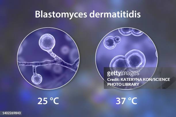 ilustraciones, imágenes clip art, dibujos animados e iconos de stock de blastomyces fungus, illustration - blastomicosis