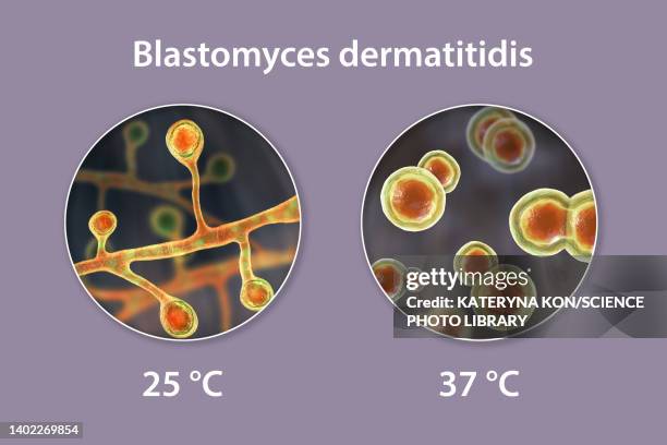 ilustraciones, imágenes clip art, dibujos animados e iconos de stock de blastomyces fungus, illustration - blastomicosis