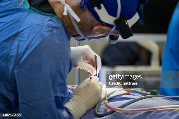 surgeon performing a delicate operation - neurosurgery stock pictures, royalty-free photos & images