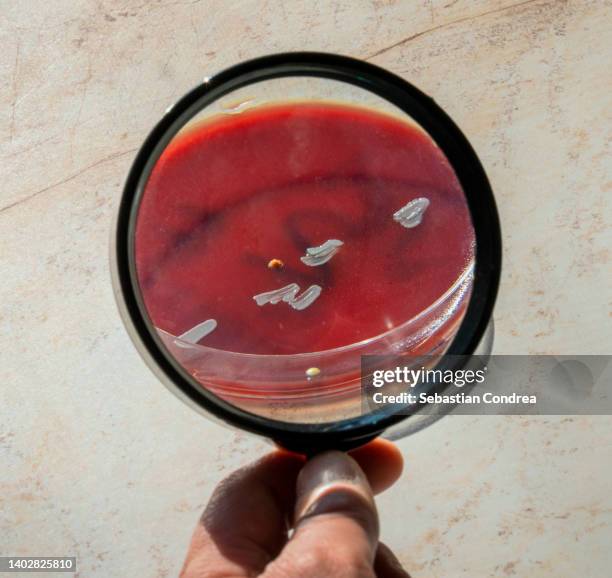monkeypox virus, under the magnifying glass. - electron micrograph stock pictures, royalty-free photos & images