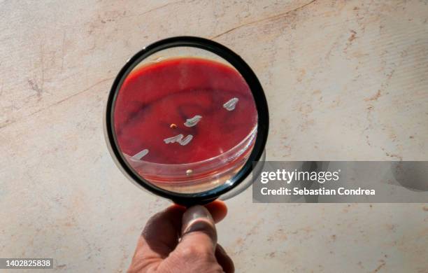 monkeypox virus, under the magnifying glass. - pocken stock-fotos und bilder