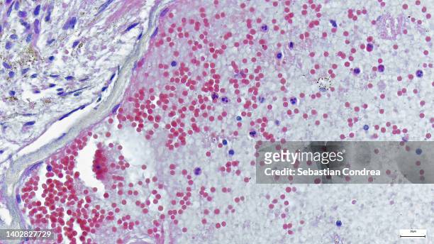 under a microscope magnification of 500x, this image depicted a section of skin tissue, monkeypox virus - versterkte kleuren stockfoto's en -beelden