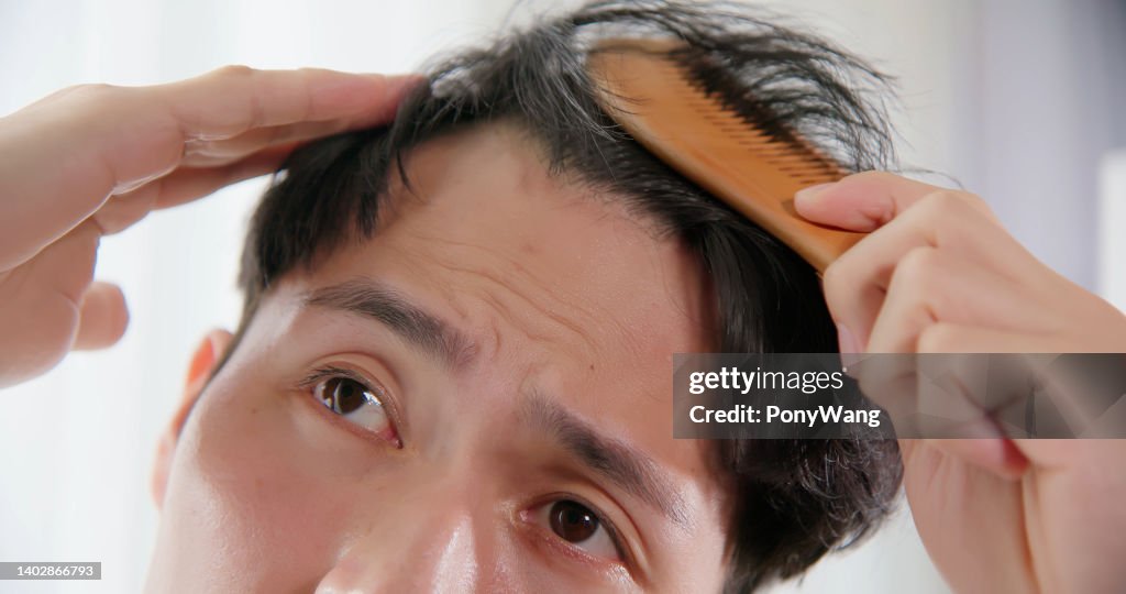 Mann besorgt über Haarausfall