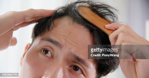 495 Mole Hair Photos and Premium High Res Pictures - Getty Images