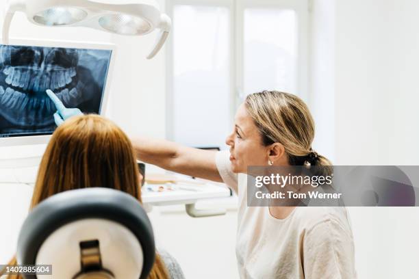 orthodontist pointing at teeth on x-ray displayed on surgery monitor - radiazione foto e immagini stock