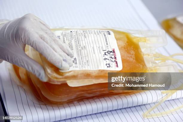 Platelets Packet Platelet Transfusion Photos and Premium High Res Pictures - Getty Images
