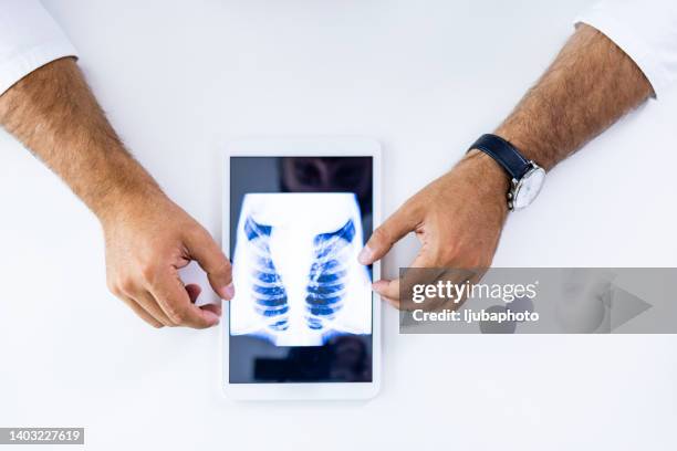 orthopedist looking at x-ray in clinic - long table stockfoto's en -beelden