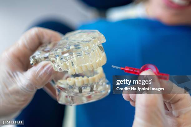 close-up of plastic model of teeth. - gesundheitsvorsorge stock-fotos und bilder