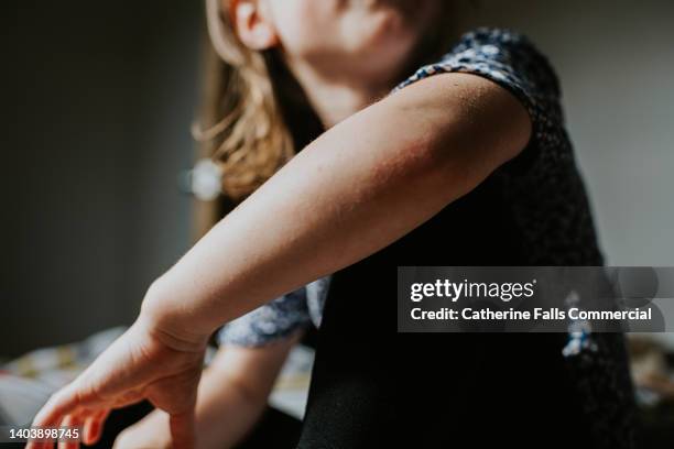 a close-up, focusing on a little girls arm - elbow skin stock pictures, royalty-free photos & images