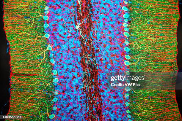 Cerebellar Purkinje neurons. Brain exhibition Inside MIT Museum Building at 265 Massachusetts Avenue Cambridge, Boston Massachusetts. USA The...