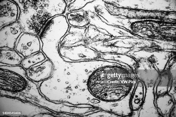 Electron micrograph of a dendritic spine. Brain exhibition Inside MIT Museum Building at 265 Massachusetts Avenue Cambridge, Boston Massachusetts....