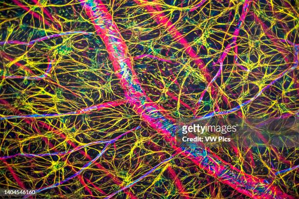 Astrocytes and blood vessels within the retina. Brain exhibition Inside MIT Museum Building at 265 Massachusetts Avenue Cambridge, Boston...
